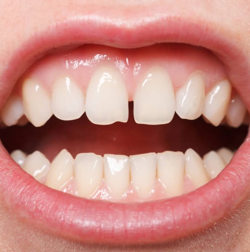 blog - Cheadle Hulme Dental
