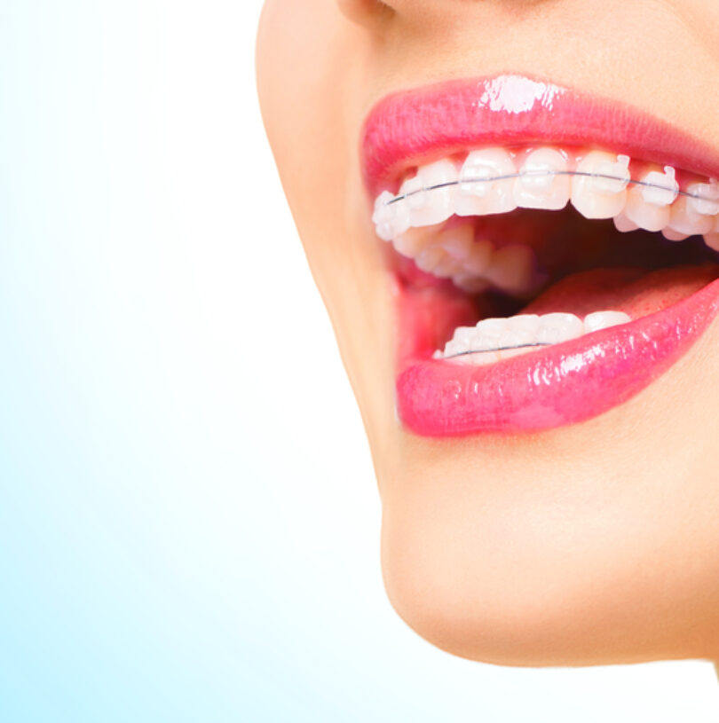Hulme Orthodontics