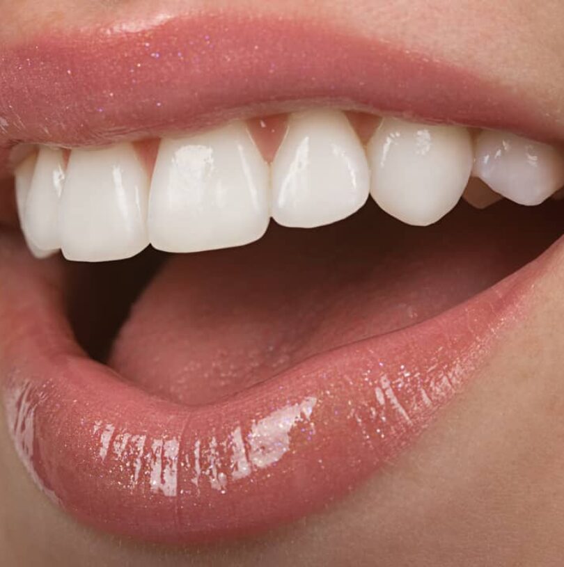 Smiles Dental Manchester