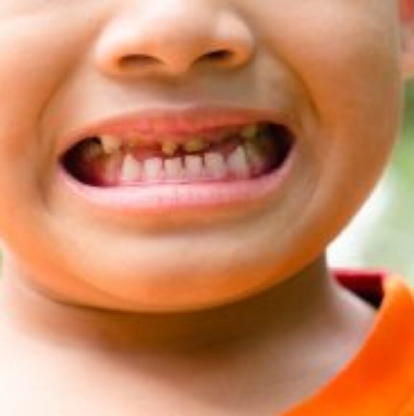 blog - Cheadle Hulme Dental