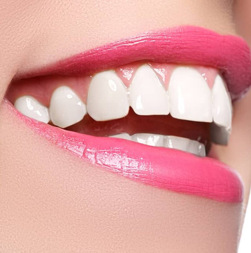 blog - Cheadle Hulme Dental