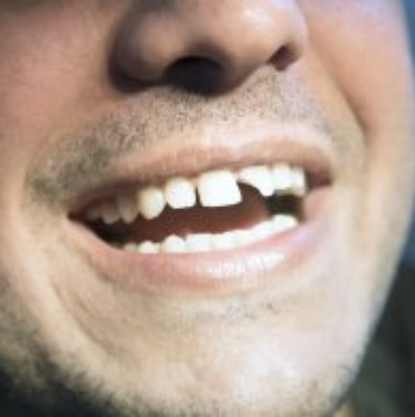 blog - Cheadle Hulme Dental