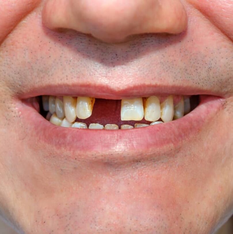 Emergency Dentist Manchester