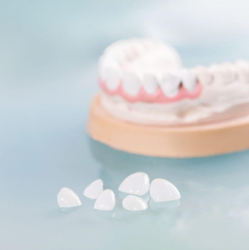 Dental Implants Manchester