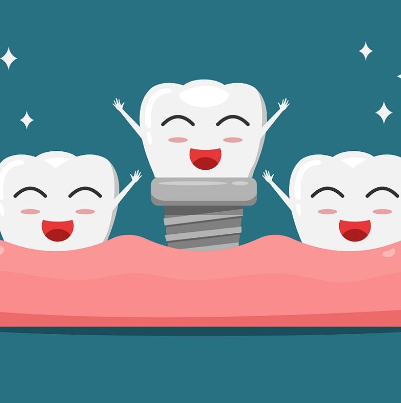 Dental Implants Manchester