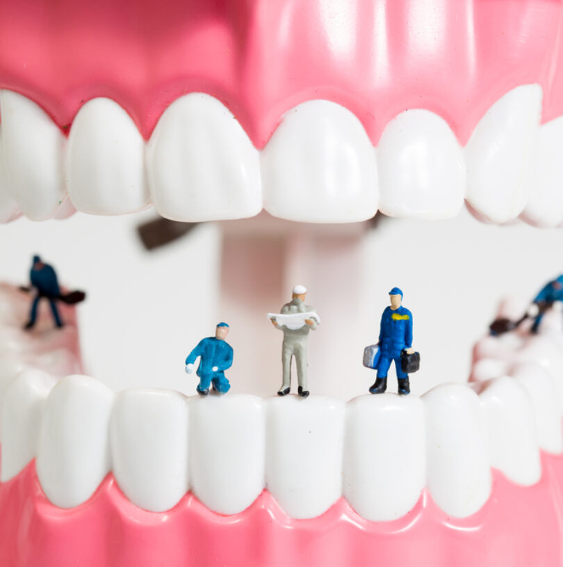 blog - Cheadle Hulme Dental