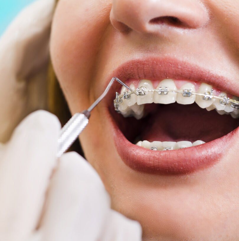blog - Cheadle Hulme Dental
