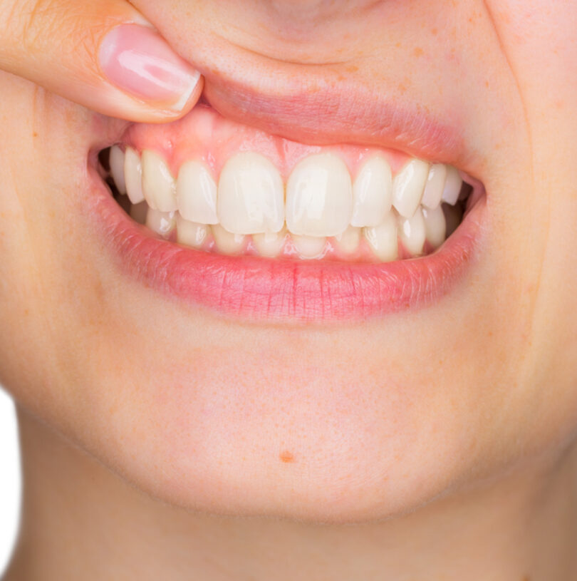 blog - Cheadle Hulme Dental