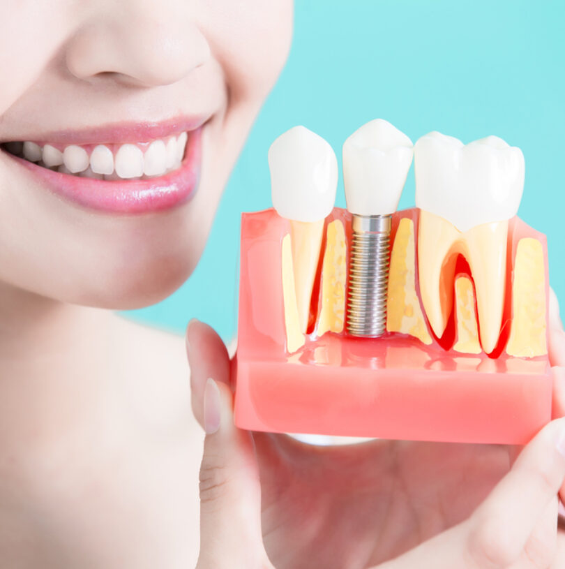 blog - Cheadle Hulme Dental