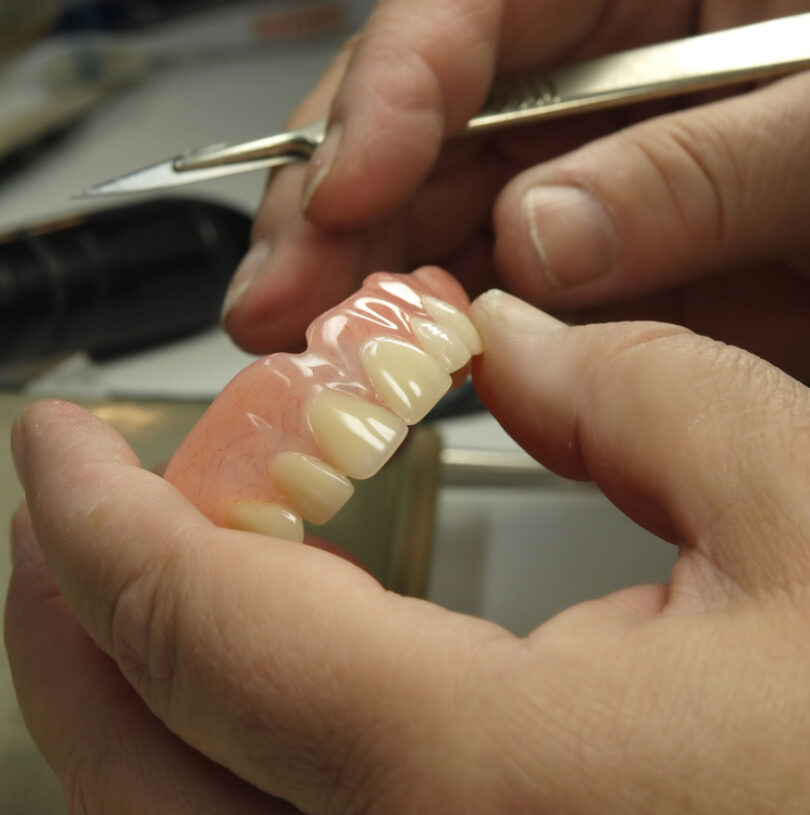 blog - Cheadle Hulme Dental