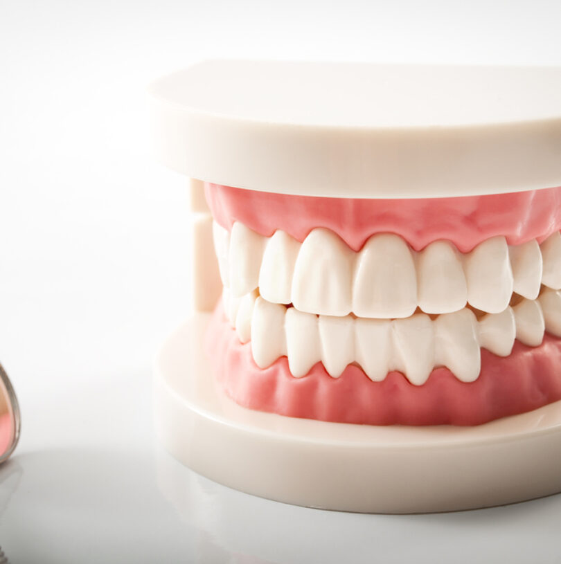 Dental Implants Manchester | Cosmetic Dentist Church Road