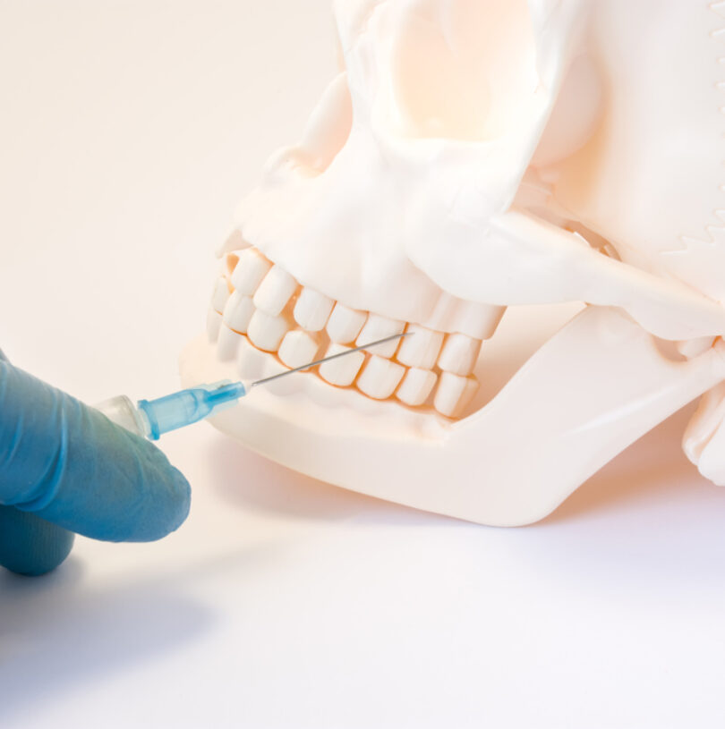 blog - Cheadle Hulme Dental