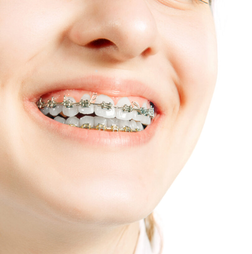 blog - Cheadle Hulme Dental