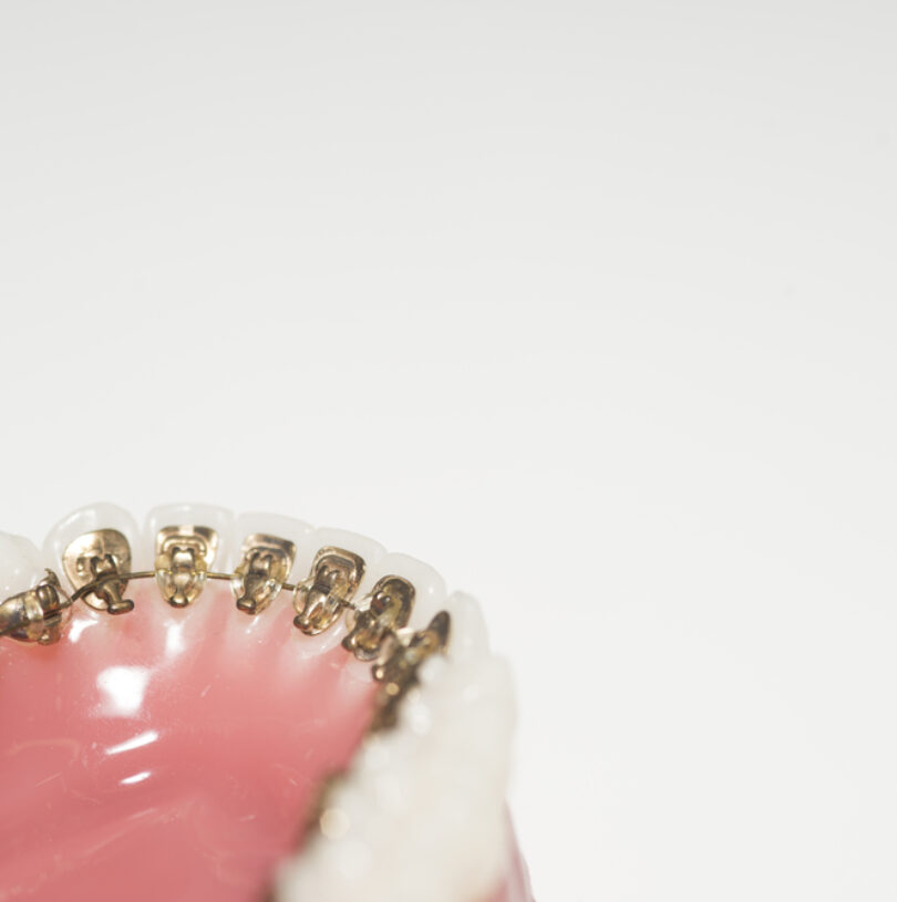 blog - Cheadle Hulme Dental