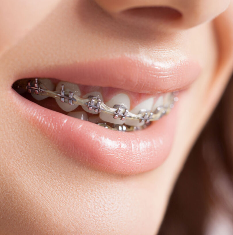 blog - Cheadle Hulme Dental