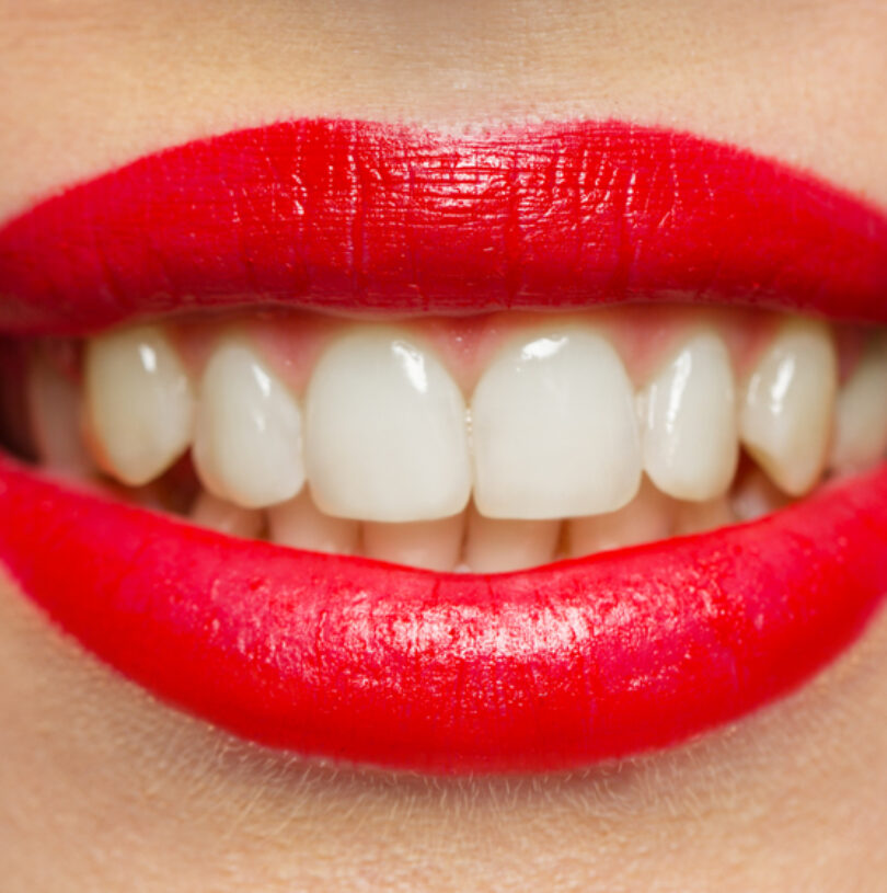 Smile Makeovers Manchester