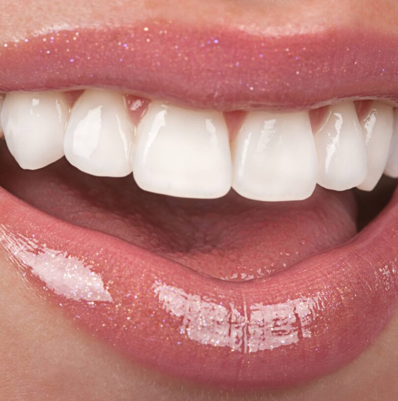Smile Makeovers Manchester