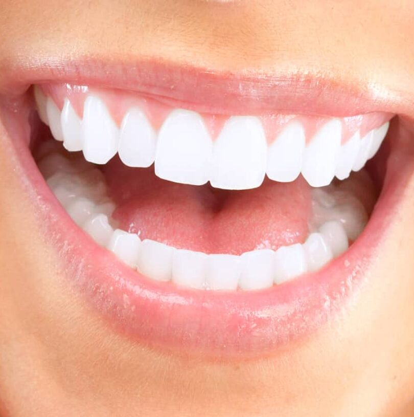 Cosmetic Dentistry in Manchester