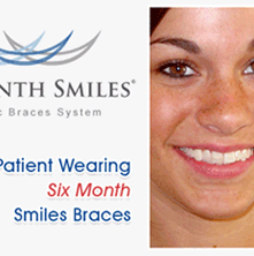 blog - Cheadle Hulme Dental