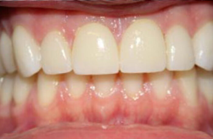 After - Cheadle Hulme Dental