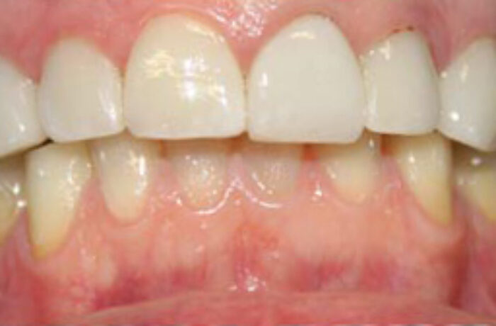 After - Cheadle Hulme Dental