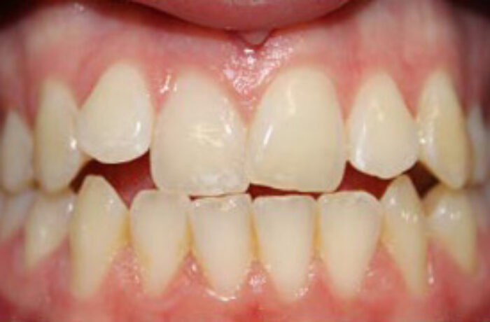 Before - Cheadle Hulme Dental
