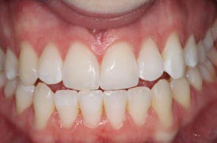 After - Cheadle Hulme Dental