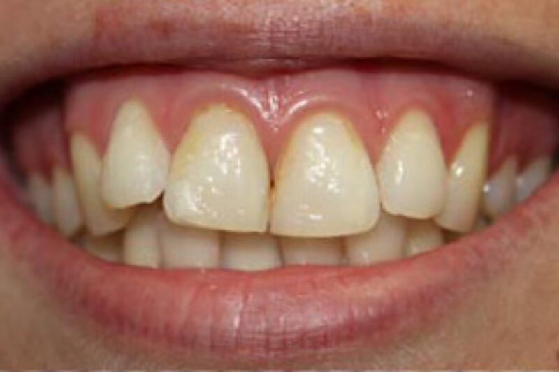 Before - Cheadle Hulme Dental