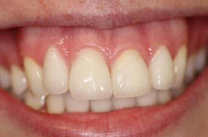 After - Cheadle Hulme Dental