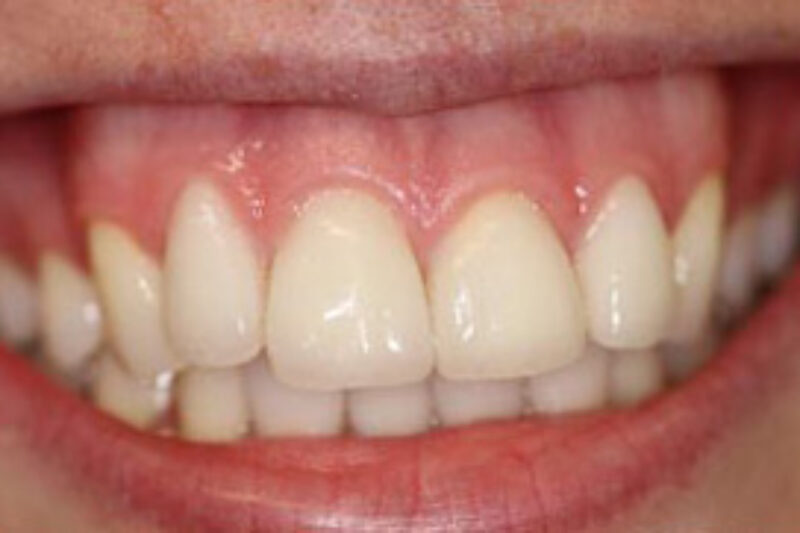 After - Cheadle Hulme Dental