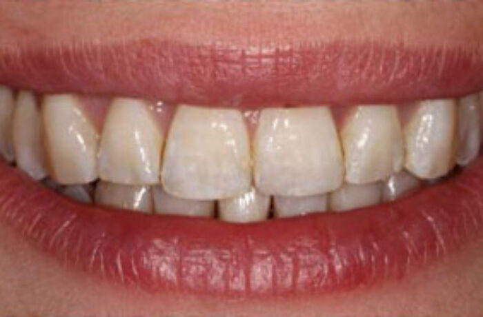 After - Cheadle Hulme Dental