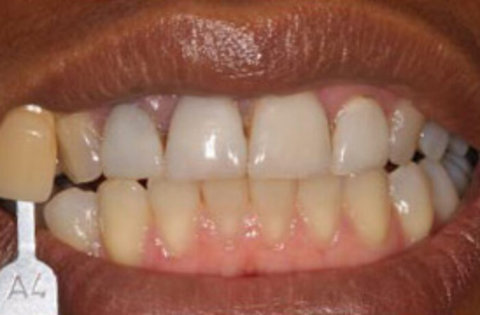 Before - Cheadle Hulme Dental
