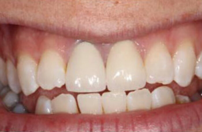 Before - Cheadle Hulme Dental