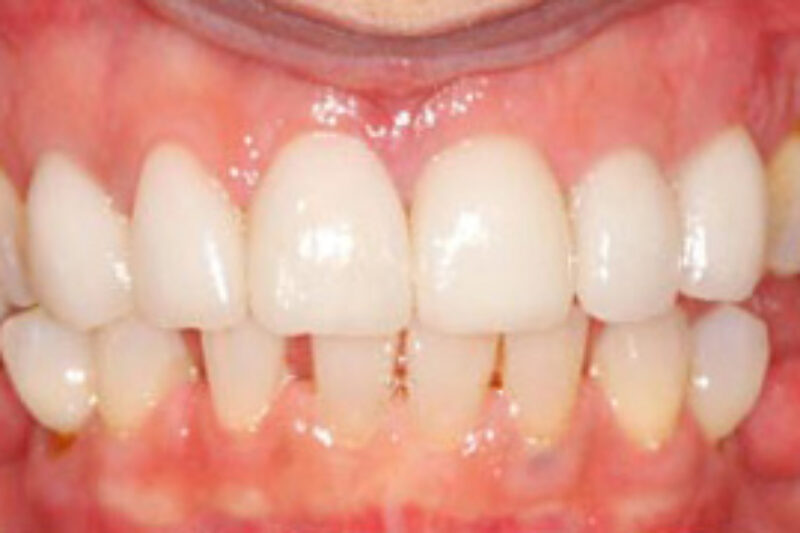 After - Cheadle Hulme Dental