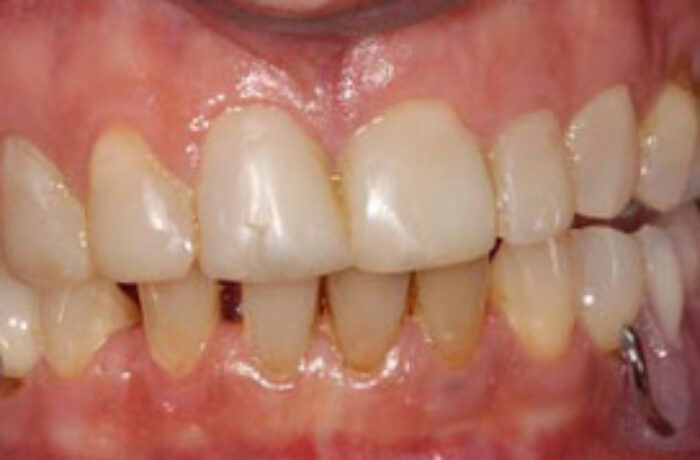 Before - Cheadle Hulme Dental