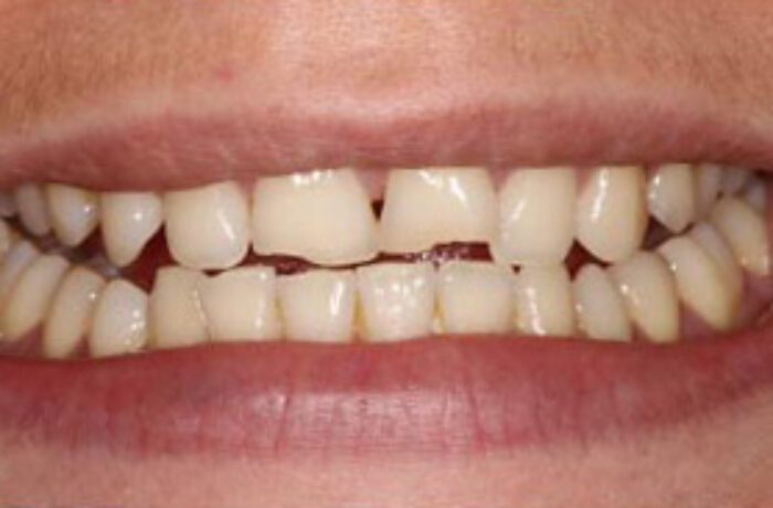 Before - Cheadle Hulme Dental