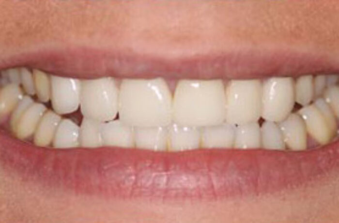 After - Cheadle Hulme Dental