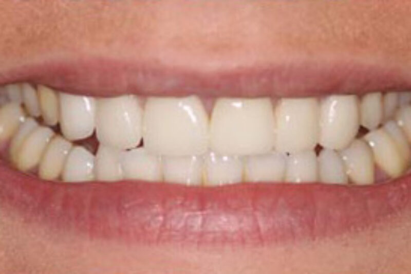 After - Cheadle Hulme Dental