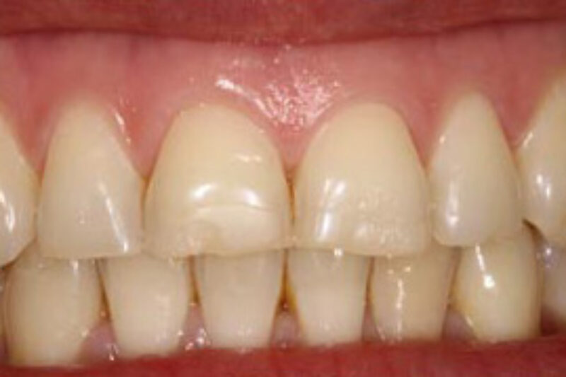 Before - Cheadle Hulme Dental