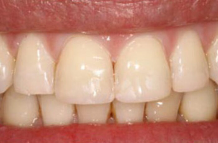 After - Cheadle Hulme Dental