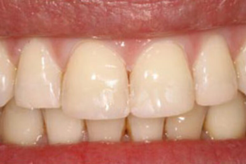 After - Cheadle Hulme Dental