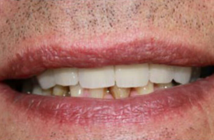 After - Cheadle Hulme Dental