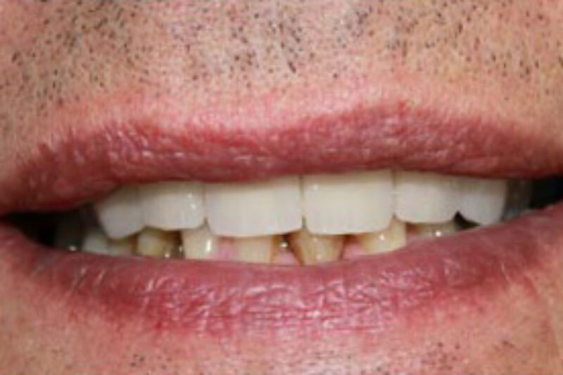 After - Cheadle Hulme Dental