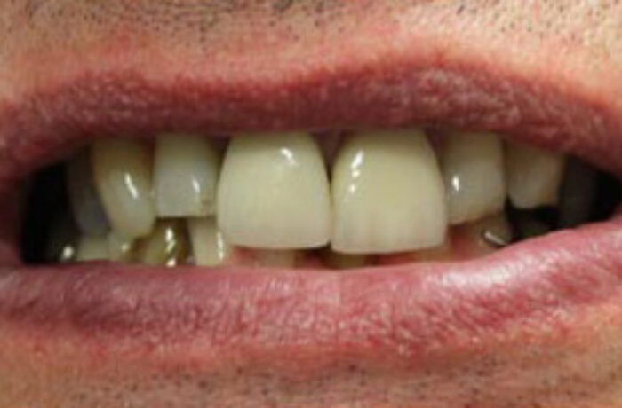 Before - Cheadle Hulme Dental