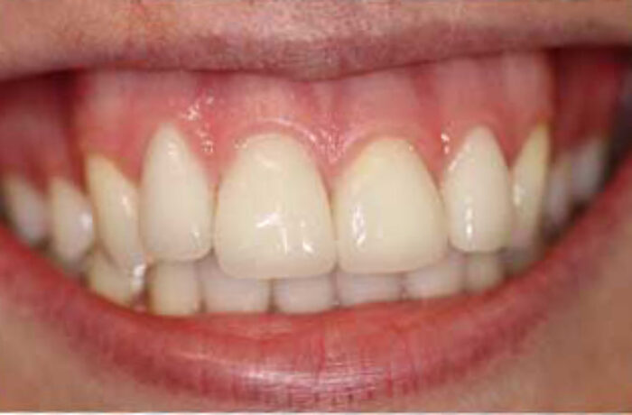 After - Cheadle Hulme Dental