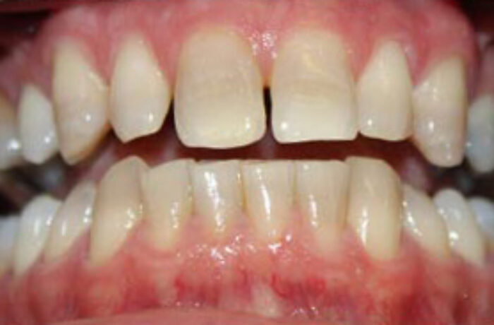 Before - Cheadle Hulme Dental