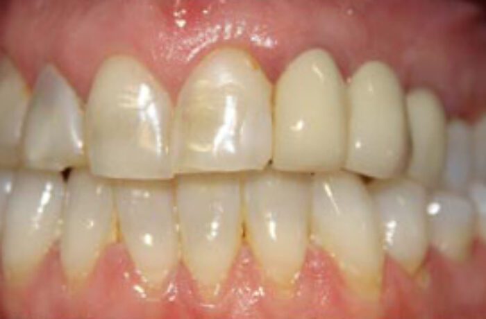 Before - Cheadle Hulme Dental