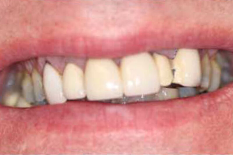 Before - Cheadle Hulme Dental