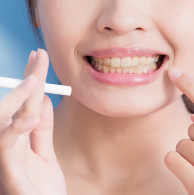 blog - Cheadle Hulme Dental