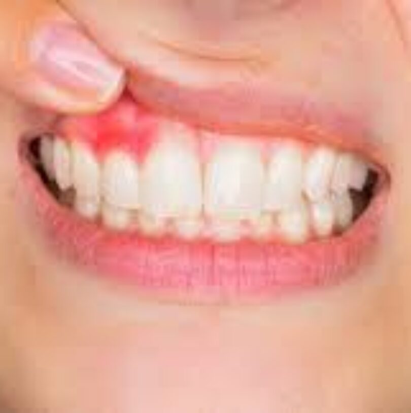 blog - Cheadle Hulme Dental